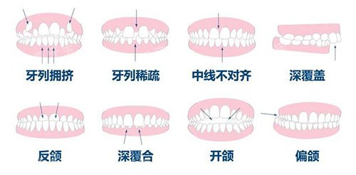 ݽӦ֢