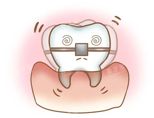 ݽɶ.webp