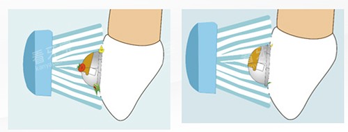 ݽOBraceвͼ