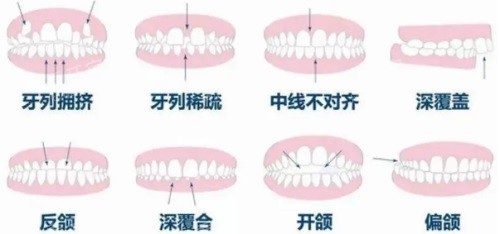 ֻʾͼ