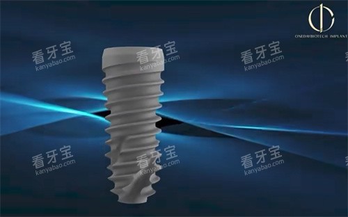 韩一种植牙植体图 韩一种植牙植体图