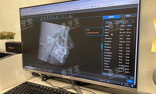 北京佳禾口腔的牙齿拍片成效展示图 北京佳禾口腔的牙齿拍片成效展示图
