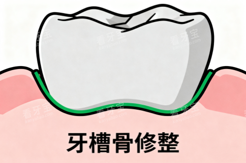 牙槽骨修整卡通图 牙槽骨修整卡通图