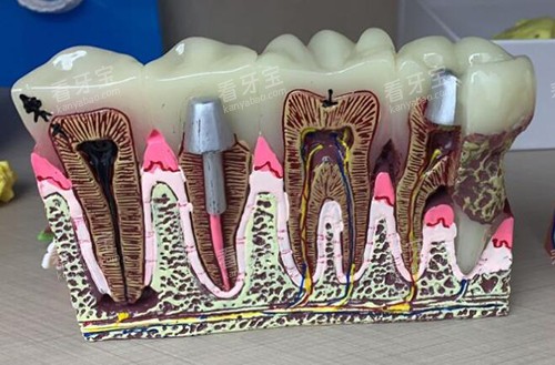 萍乡北一口腔牙齿模型 萍乡北一口腔牙齿模型