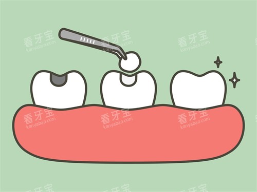 补牙漫画图示意图 补牙漫画图示意图