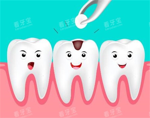 补牙改善卡通图照片 补牙改善卡通图照片