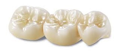 威兰德全瓷牙 威兰德全瓷牙