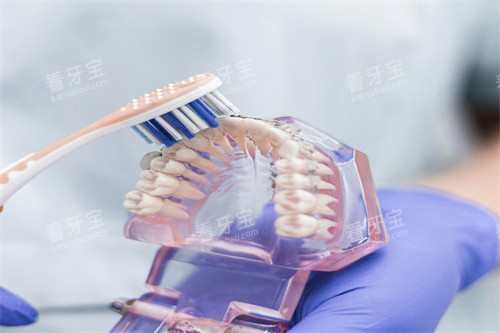 假牙模型清洗图片 假牙模型清洗图片