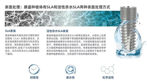 康盛种植牙表面设计图片 康盛种植牙表面设计图片