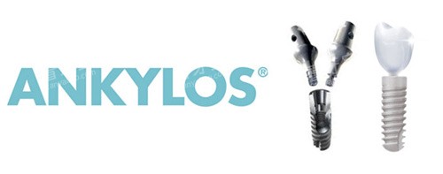 安卓健种植牙宣传图 安卓健种植牙宣传图