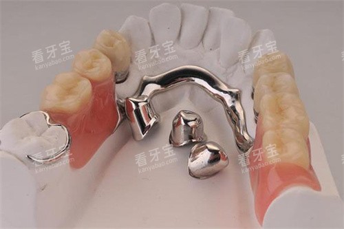 活动义齿成品 活动义齿成品