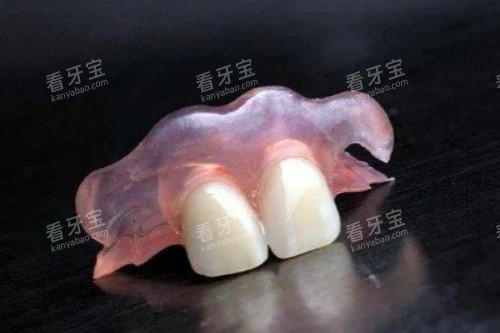 活动义齿卡通图 活动义齿卡通图