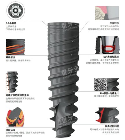 百齿泰泰锆3.0种植牙怎么样 百齿泰泰锆3.0种植牙怎么样