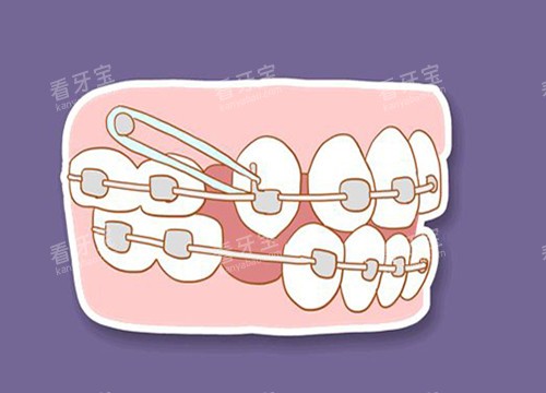 牙齿收缝卡通图片 牙齿收缝卡通图片