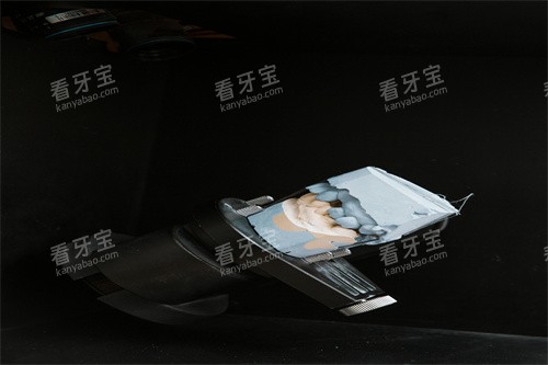 牙齿正在制作的过程 牙齿正在制作的过程