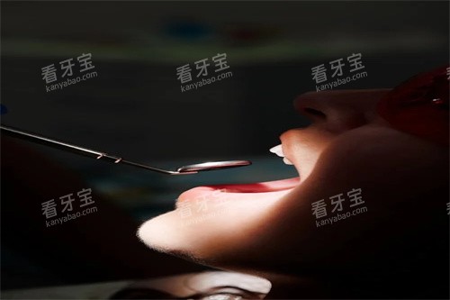 牙齿检查展示 牙齿检查展示