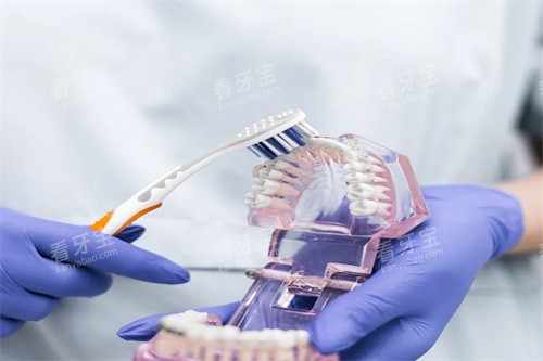 牙齿护理模型图 牙齿护理模型图