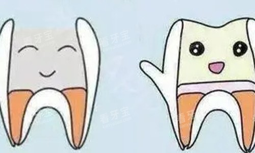 根管治疗前后对比 根管治疗前后对比