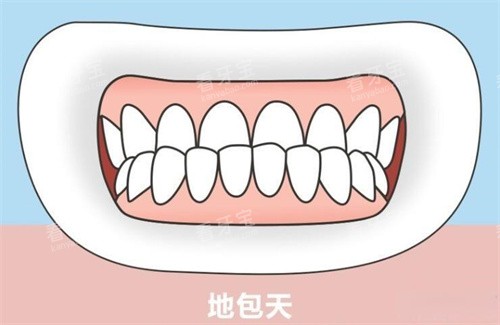 地包天正面演示动画图 地包天正面演示动画图