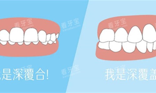 牙齿深覆合展示对比 牙齿深覆合展示对比