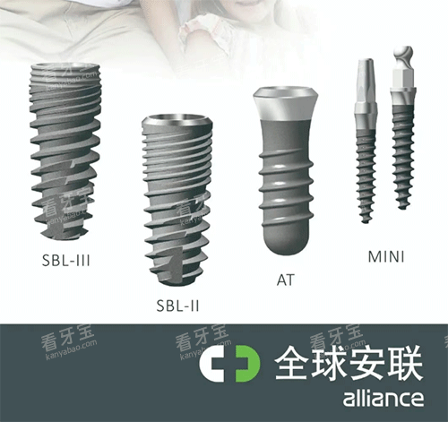 安联种植牙好不好 安联种植牙好不好