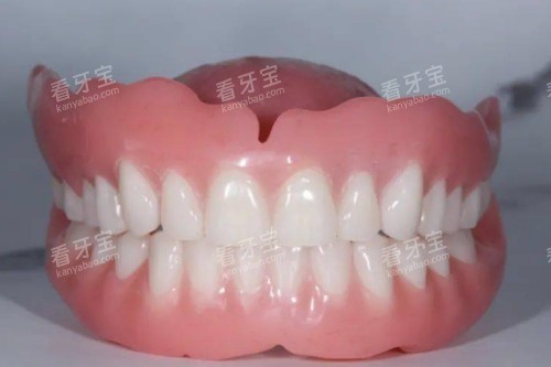 老年人假牙图片展示 老年人假牙图片展示