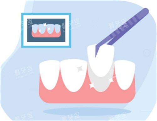 �����޸�ͼ