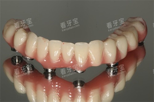 ȫ����ֲ�����