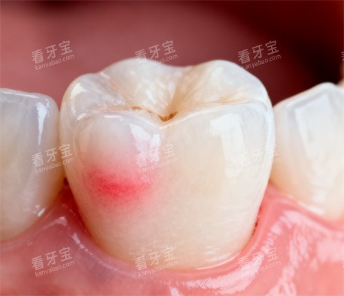 单颗牙齿图片 单颗牙齿图片