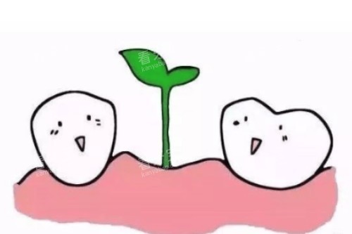 种植牙概念图 种植牙概念图