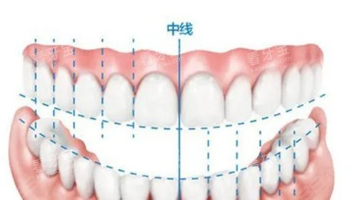 牙齿中线.webp 牙齿中线.webp