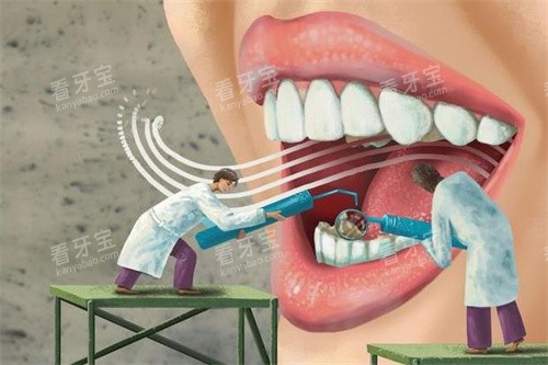 牙齿检查做治疗图 牙齿检查做治疗图