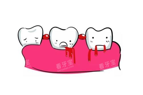 牙齿出血卡通图片展示 牙齿出血卡通图片展示