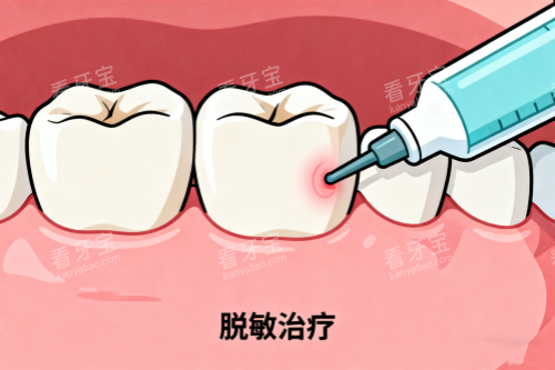 牙齿敏感治疗卡通图 牙齿敏感治疗卡通图