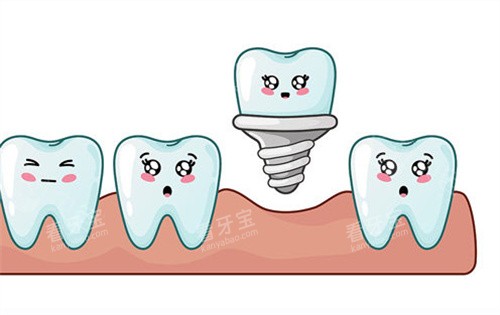 种植牙动画展示图片 种植牙动画展示图片