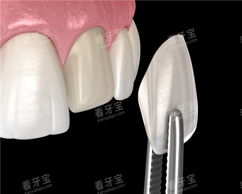 �������氲װͼ