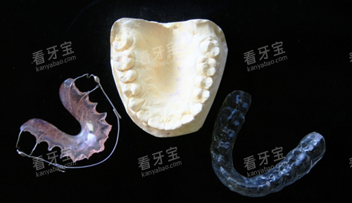 牙齿矫正模型图 牙齿矫正模型图