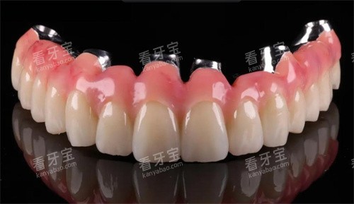 马龙桥种植牙技术 马龙桥种植牙技术