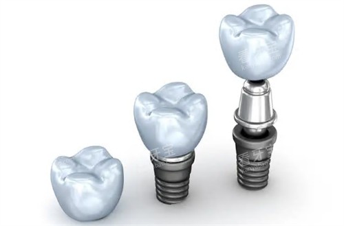 ��ֲ����̨����