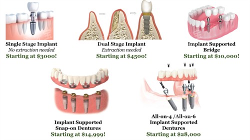 ��ֲ����������ͼ