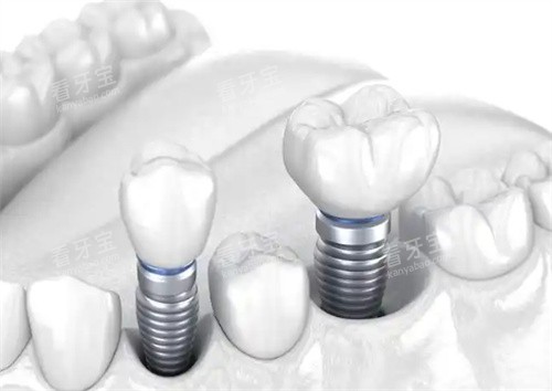 ��ֲ��ͼƬչʾ