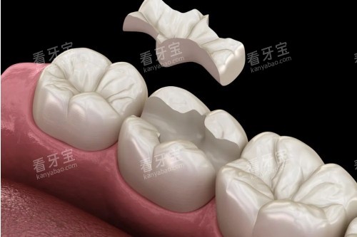 Ƕ�岹����ͨͼ