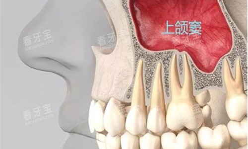 牙齿内部展示图 牙齿内部展示图
