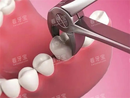 ��������ͼ