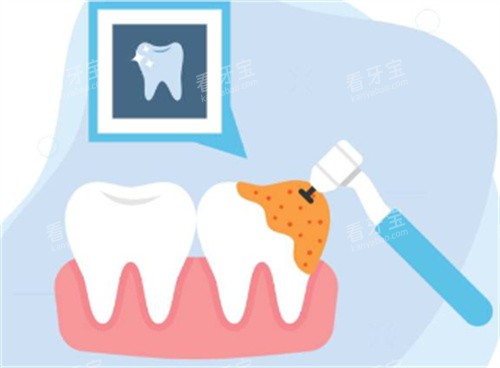 ������������ͼ