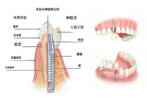 ��ֲ������ͼ