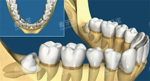 �ǳ����ݶ���ͼ