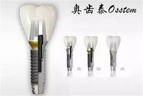 �³�̩��ֲ������ϵ��