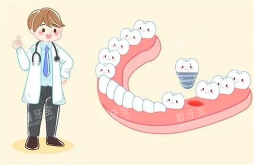 种植牙安装动画图 种植牙安装动画图