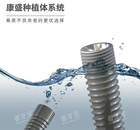 康盛种植牙怎么样 康盛种植牙怎么样